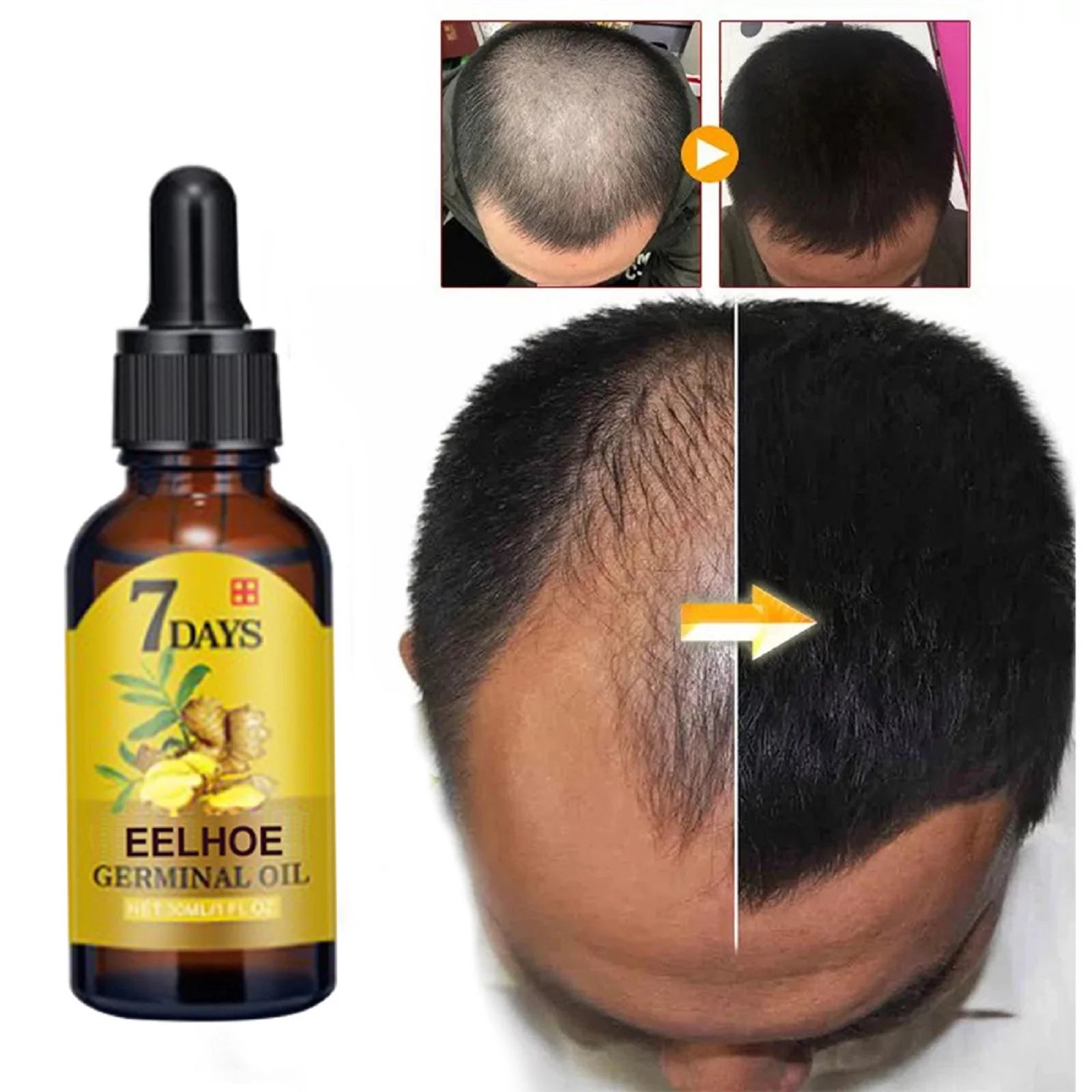 Hair Care Oil